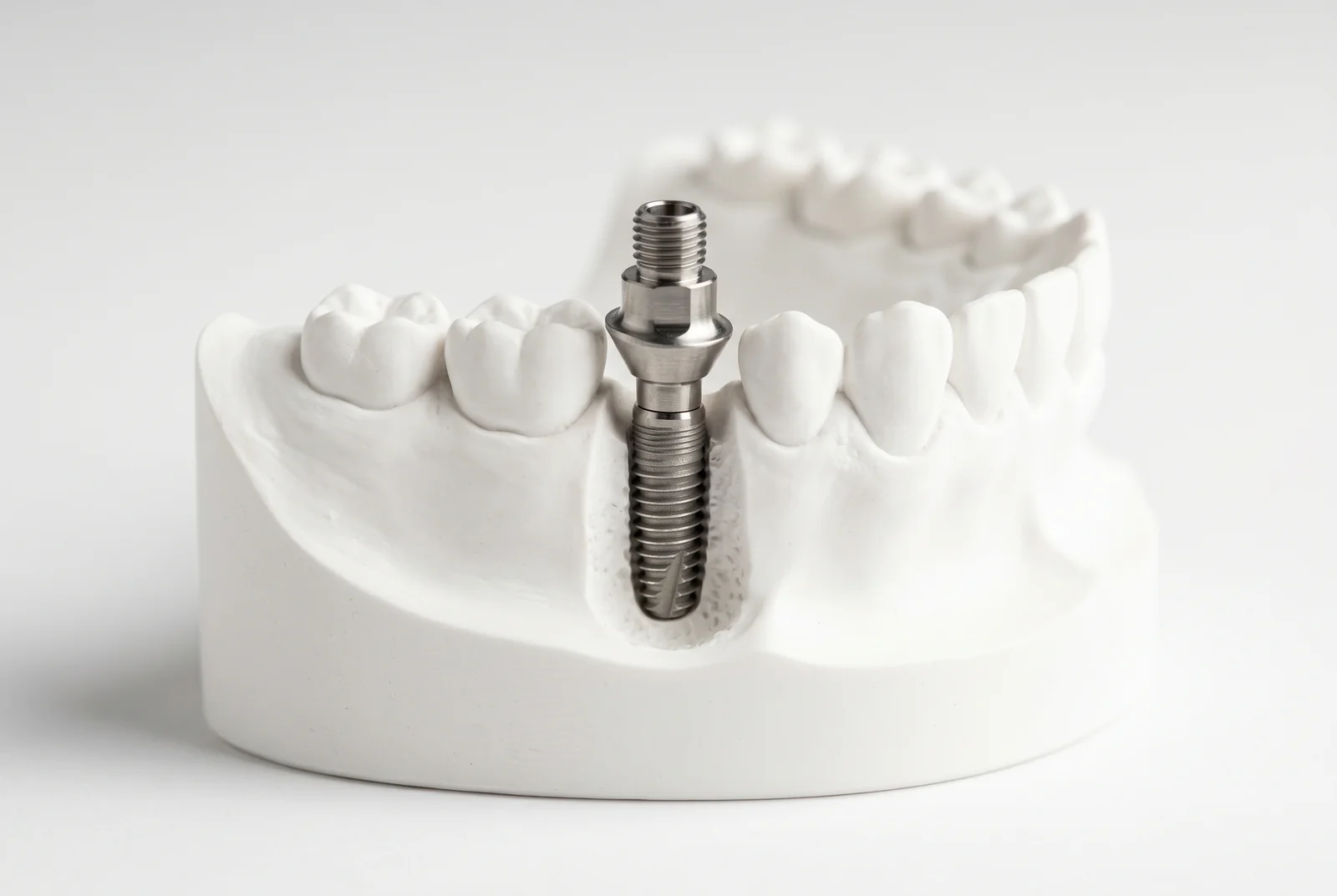 Ce mananci dupa implant dentar - Ghid post-operator
