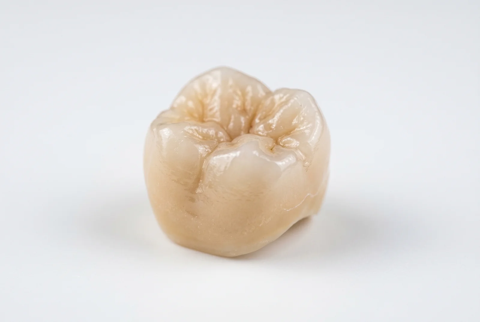 Coroana dentara pe implant pret - Afla costurile si beneficiile