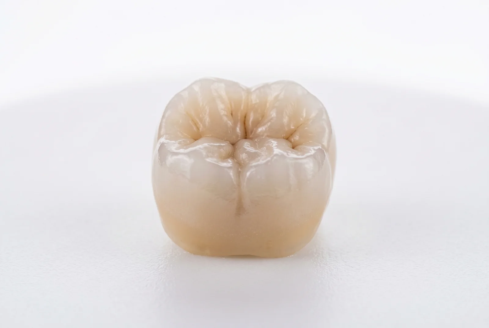 Coroana pe pivoti pret - Avantaje si costuri la Anghele Dental