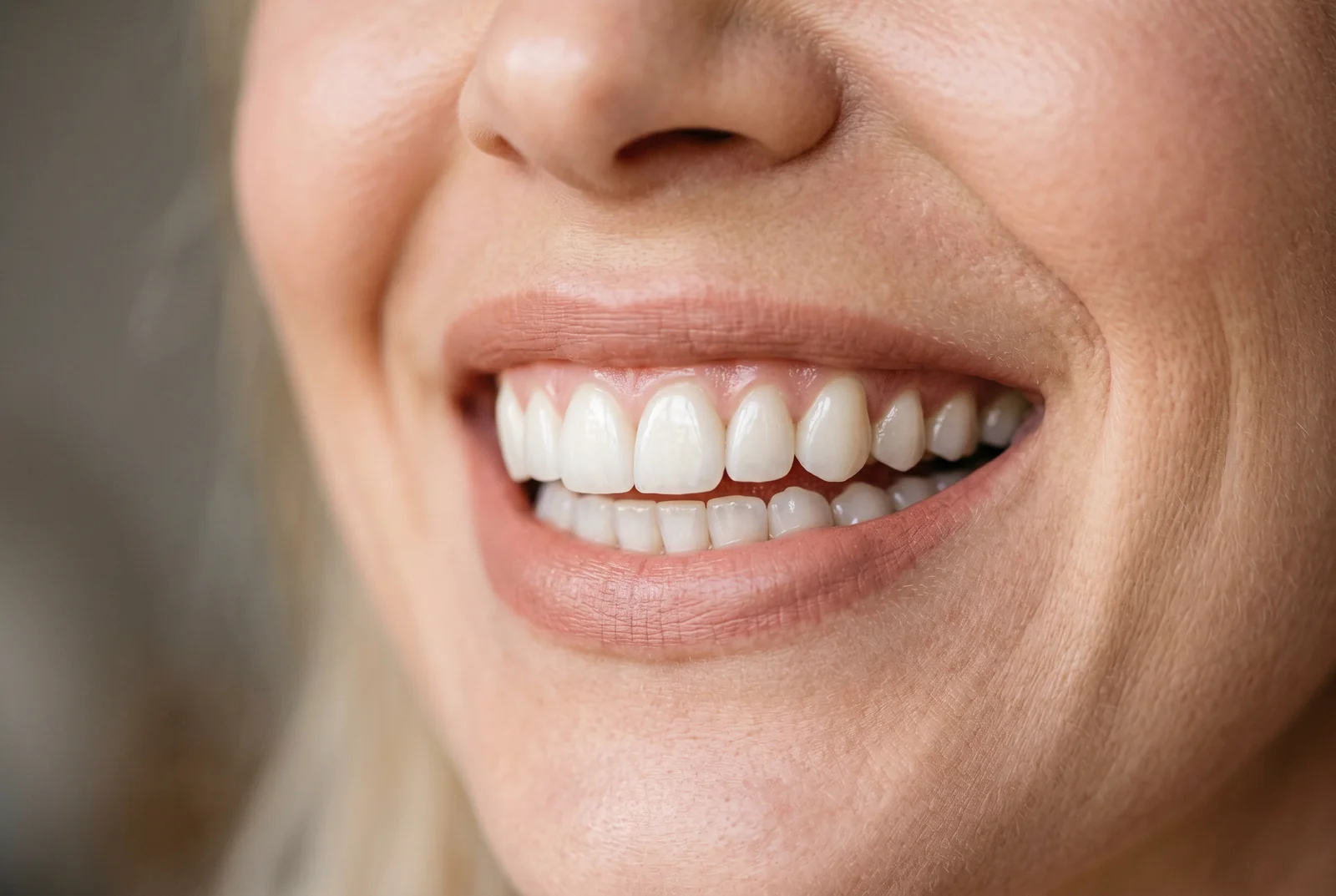 Fatete dentare inainte si dupa - Transformari spectaculoase